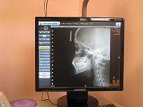 томография черепа человека